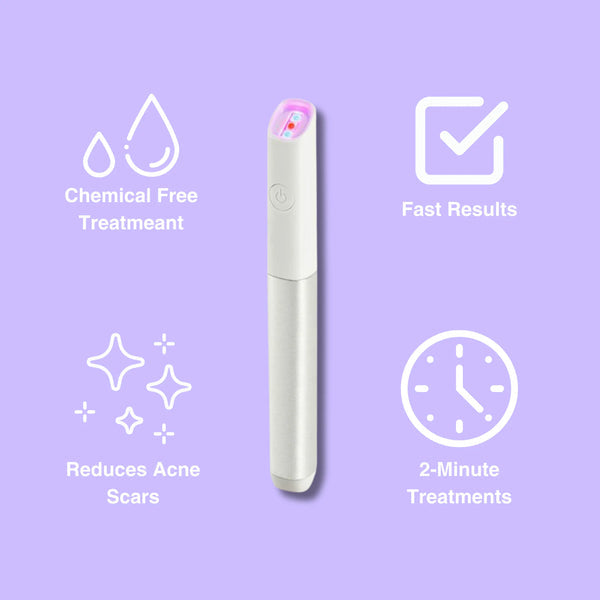 Acne-Vanish Pro (80% OFF TODAY ONLY)